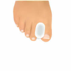 Toe Separator
